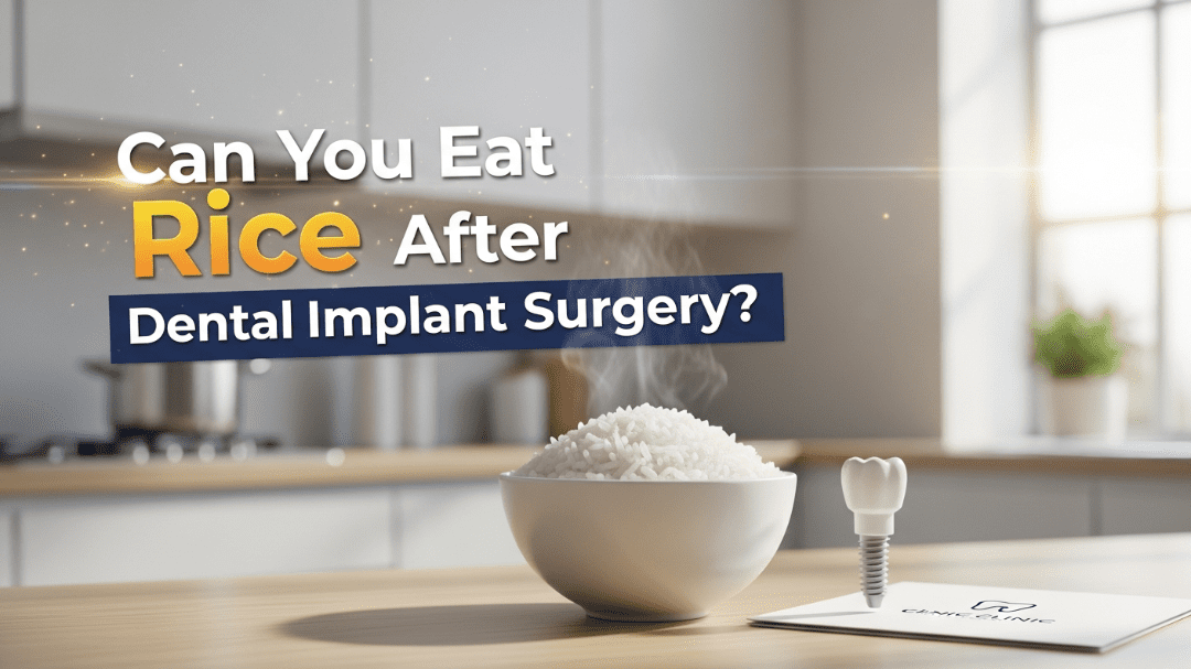 Can You Eat Rice After Dental Implant Surgery? Complete Guide