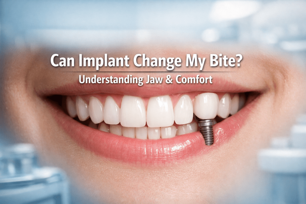 Can implant change my bite