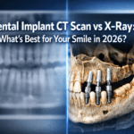 Dental implant CT scan vs X-ray