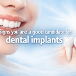 Signs you are a good candidate for dental implants