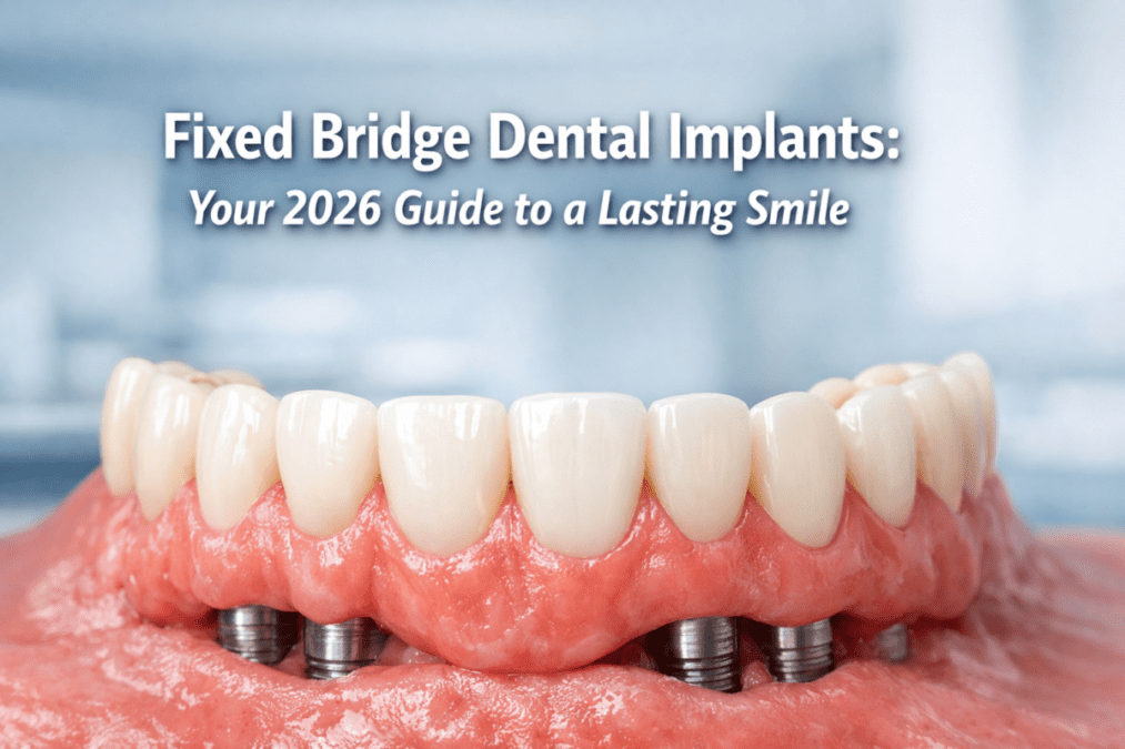 Fixed Bridge Dental Implants: 2026 Guide to a New Smile in D