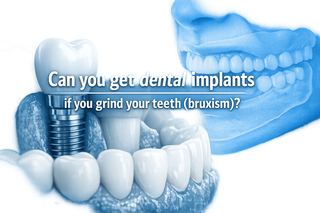 Can you get dental implants if you grind your teeth (bruxism)?