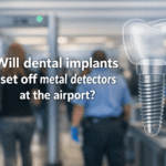 Will dental implants set off metal detectors at the airport?